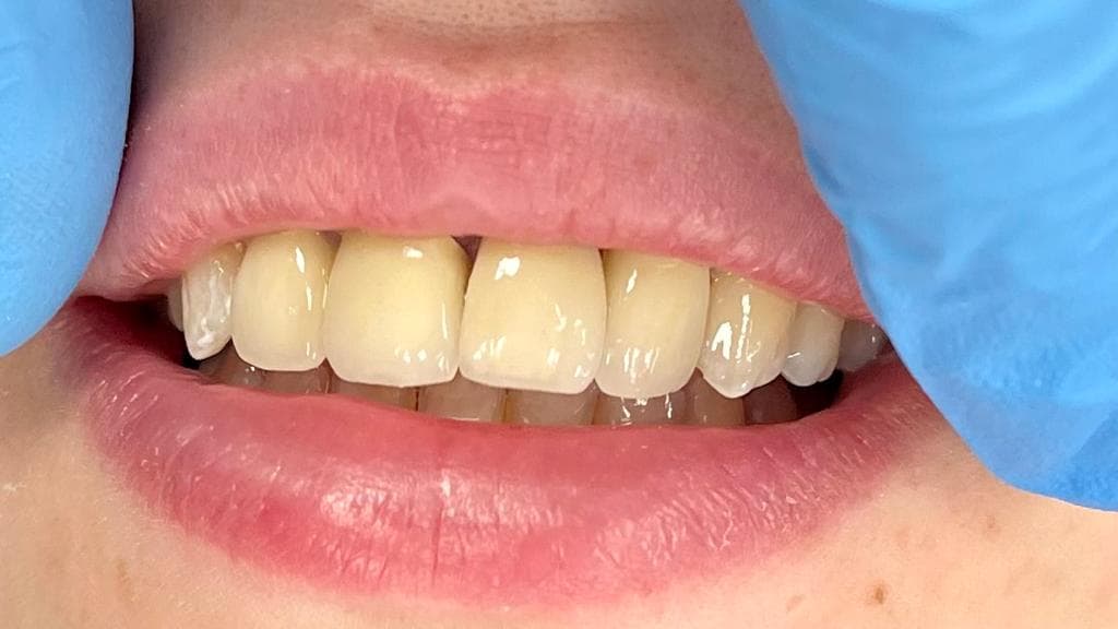 Harmonie esthétique du sourire