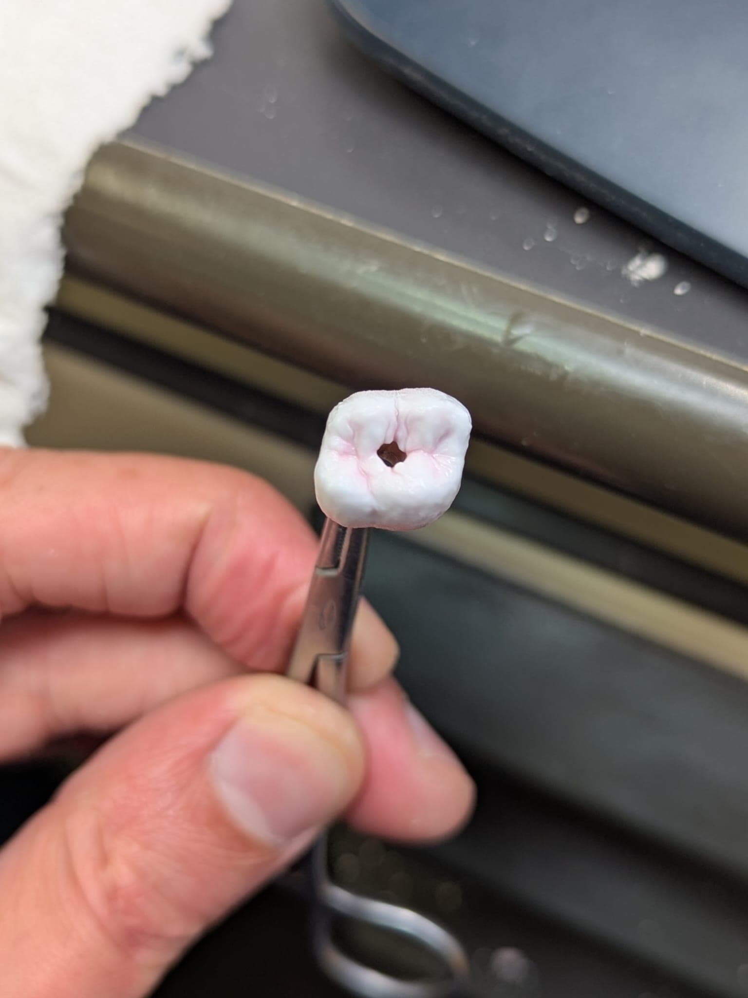 Bridge sur implants